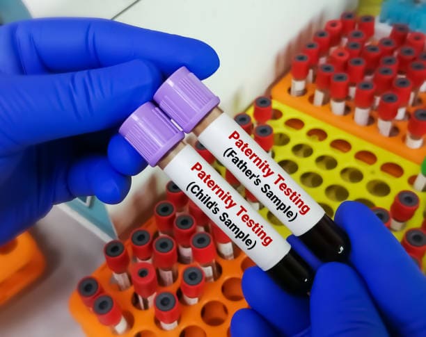 Blood Samples for Paternity Testing, one from the Child's Sample and one from the Father's Sample